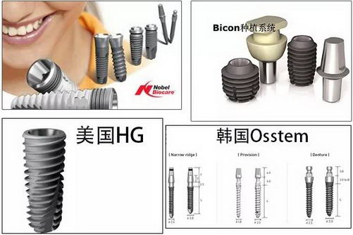 ֲѡĸƷƺãһҪѡ𣿿ҽô˵