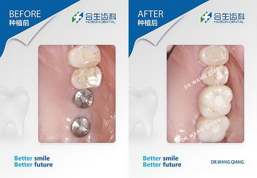 ֲѡĸƷƺãһҪѡ𣿿ҽô˵