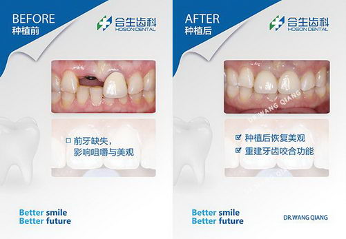 ֲѡĸƷƺãһҪѡ𣿿ҽô˵