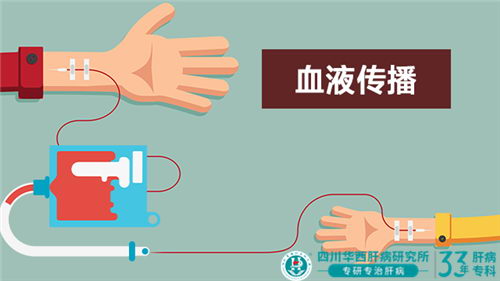 成都华西肝病研究所治疗肝病好不好?318开启爱肝护肝公益行