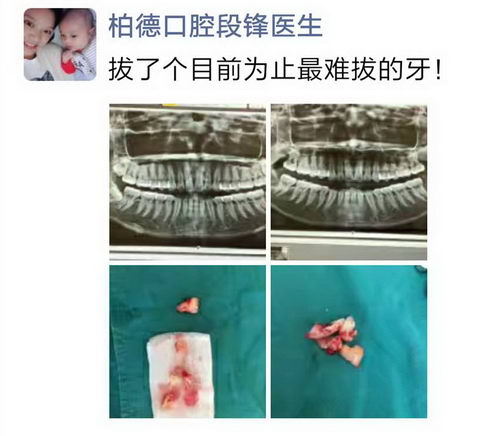 ֲĺ޷ǾǰˣɾԼص¿ǻηҽ