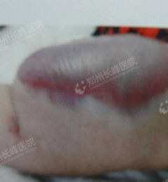 Ѫ�����ǲ��Ǵ�����������֪����ʲô�취�ж���