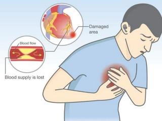 进口瑞舒伐他汀钙片适合高血脂患者吗?有什么优势呢?