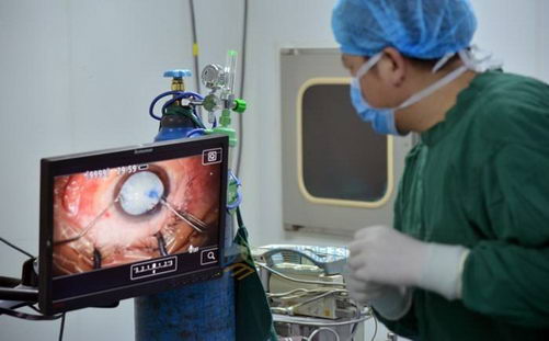 在宜昌做白内障手术