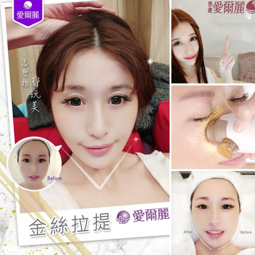 拉皮除皱陷阱多,如何选择?爱尔丽金丝拉皮黄金奈米化爱美0风险