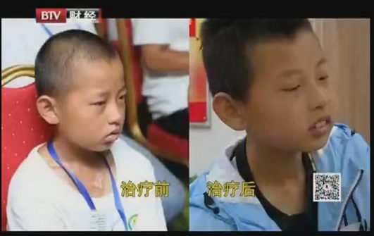 315晚会“诚信代言人”北京国丹白癜风医院院长高毓梅