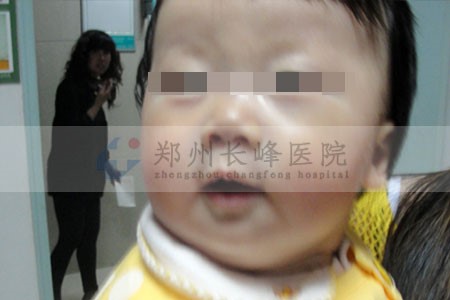 �����۾��ϵ�Ѫ�����������ܲ����κã�