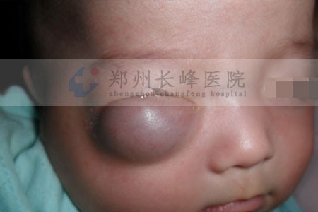 �����۾��ϵ�Ѫ�����������ܲ����κã�