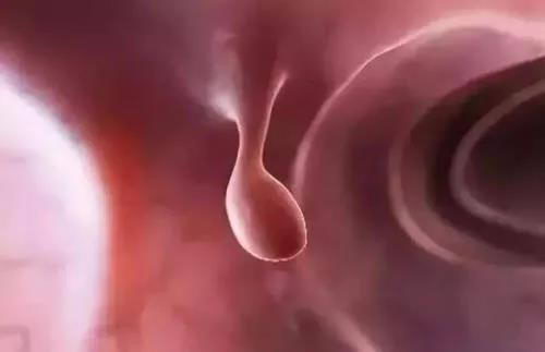 سҽԺ ΪʲôϢг˻Ḵ