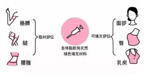 韩啸医生解析自体脂肪移植成活率有多高?