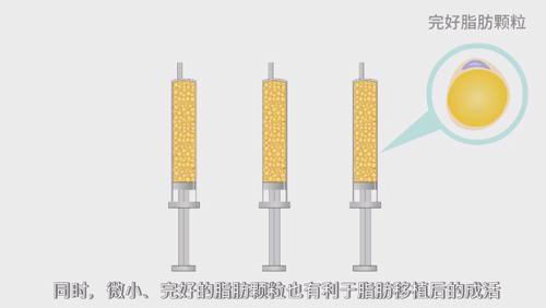 韩啸医生解析自体脂肪移植成活率有多高?