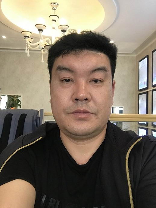 李方奇分析:硅油取出开刀切除和微创取出哪种更好?