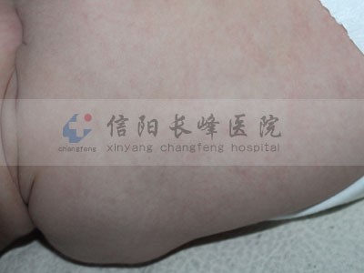 ݮ״ѪĲ᲻һɢΪ㽲