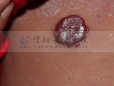 ݮ״ѪĲ᲻һɢΪ㽲