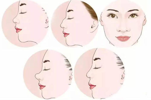 上海玫瑰医疗美容医院隆鼻怎么样?为您解析