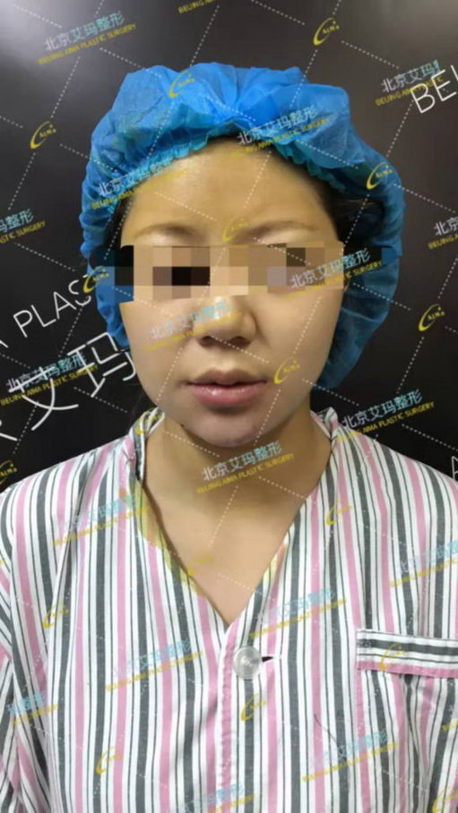 李方奇科普:你踩中“不明注射物”的雷区了吗