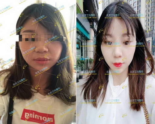 李方奇科普:你踩中“不明注射物”的雷区了吗