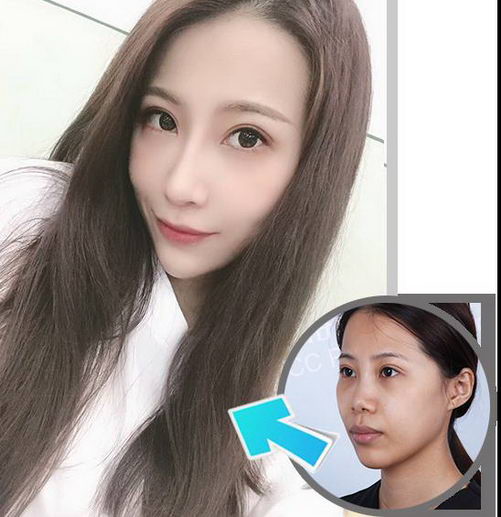 你想知道宛若天成的“妈生款”美鼻的前世今生吗?4月27日直播间等你!