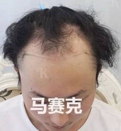 �ൺ����΢��ֲ��3002��λ����д�ѷ�������