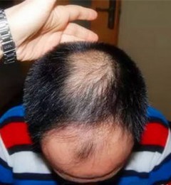 �ൺ����ͷ������ֲ������Ч������������������ͷ��ϡ��ķ���