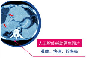 全民狂欢开启,美年引爆大健康市场