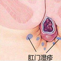 ĴسҽԺô רҽ5Ԥʪ