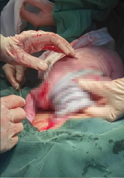 +λ+Ѹ֢+ƾ6ܣҽԺν~