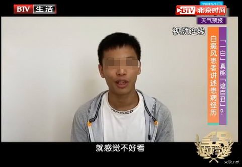 北京国丹白癜风医院王家怀主任做客BTV全民健康学院