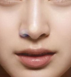 ����¡�Ǻ��ܱ��ֶ���ϼ�����������ҽ������רҵ