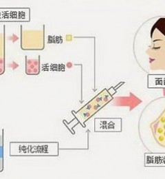 ����ͮ������ҽԺ���о���֬����ֲ�Ĵ�Ҫ�㡱���ݺ���