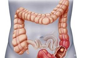 ֱĸΣȺԤɸָϹ㶫ҽԺЩע