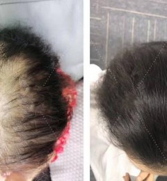 ����˿����������  �����ػ������㷢,���޺��֮��