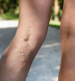 ��վ�׾������� ������Ԥ����Ч�°빦��