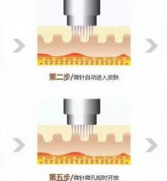 ͭȸ̨ӱ ƽƵ΢붼ܽЩ