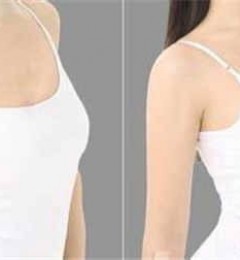 有颜有胸太迷人,如何让假体隆胸更安全