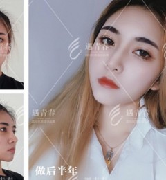 ȫ�¼��������ഺ�沿�������������豸����Ƽ���˥���˳�