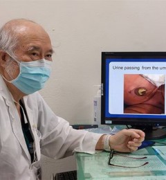 新生儿肚脐喷尿液?多与脐尿管囊肿破裂有关