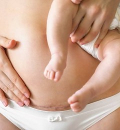 剖腹产后二胎分娩方式对女性的健康风险