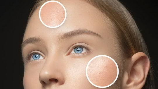 心情不好为何会影响皮肤肤质?