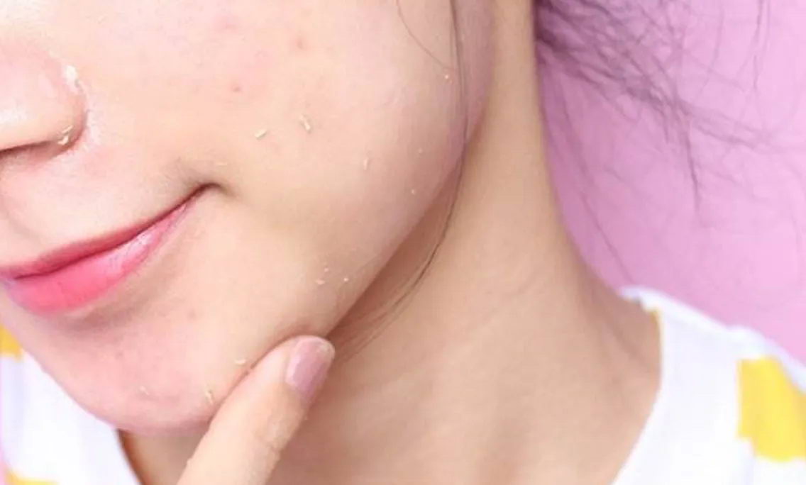 皮肤调理需乘胜追击 持续定期去角质