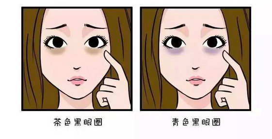 眼睛周围出现黑眼圈、眼袋 全因8大“美丽杀手”所为