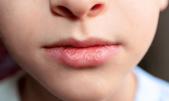 留意脸上“7警讯” 患糖尿病的高风险信号