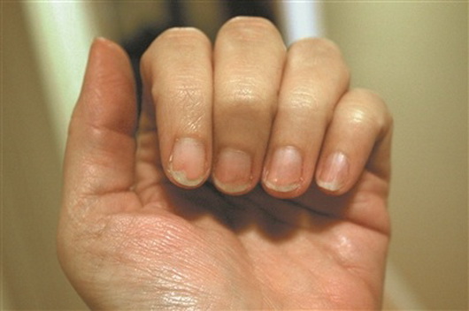 ҽƴѧоɹ ָ״лԤⰢĺĬ