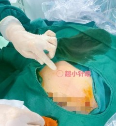 ���ݼ׿�ҽԺ���գ��ӹ��ټ���������ѡ���ڡ���ǻ�����Ǵ�ͳ����������